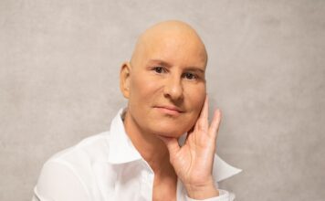 Czy podawanie chemioterapii jest bolesne? Czy podawanie chemioterapii jest bolesne?