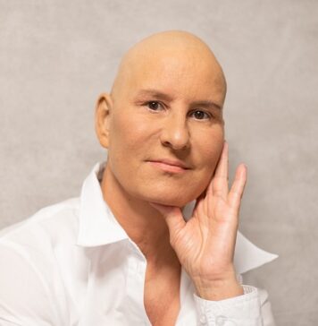 Czy podawanie chemioterapii jest bolesne? Czy podawanie chemioterapii jest bolesne?