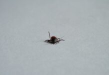 Jak pozbyć się limfy z brzucha? Jak pozbyć się limfy z brzucha?